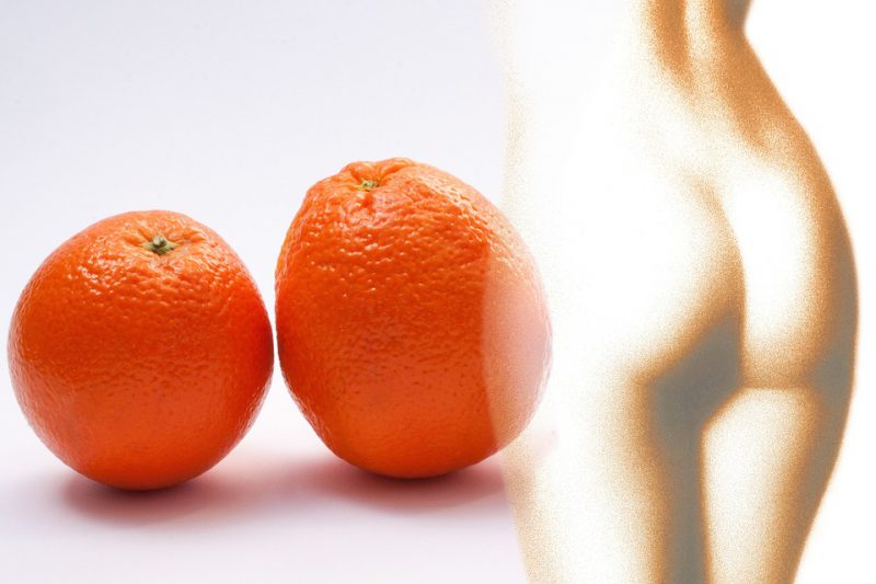 cellulit pomarańczowa skórka
